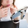 肌の悲鳴？ 皮膚科医に聞く「大人ニキビ」原因とニキビあと対策