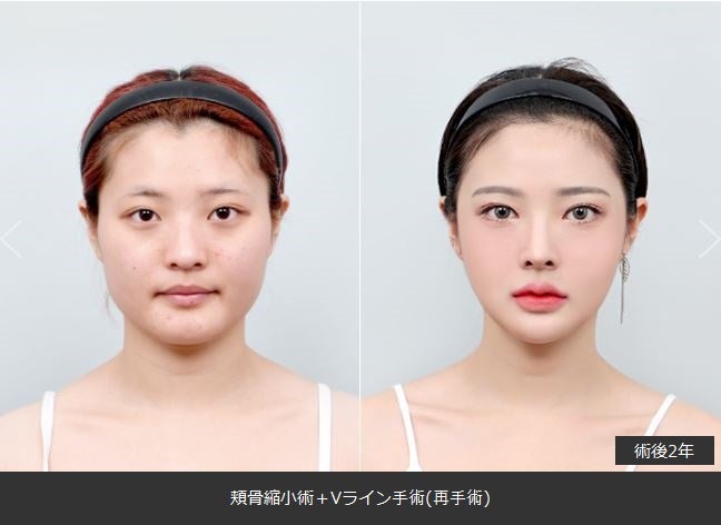 韓国　美容皮膚科